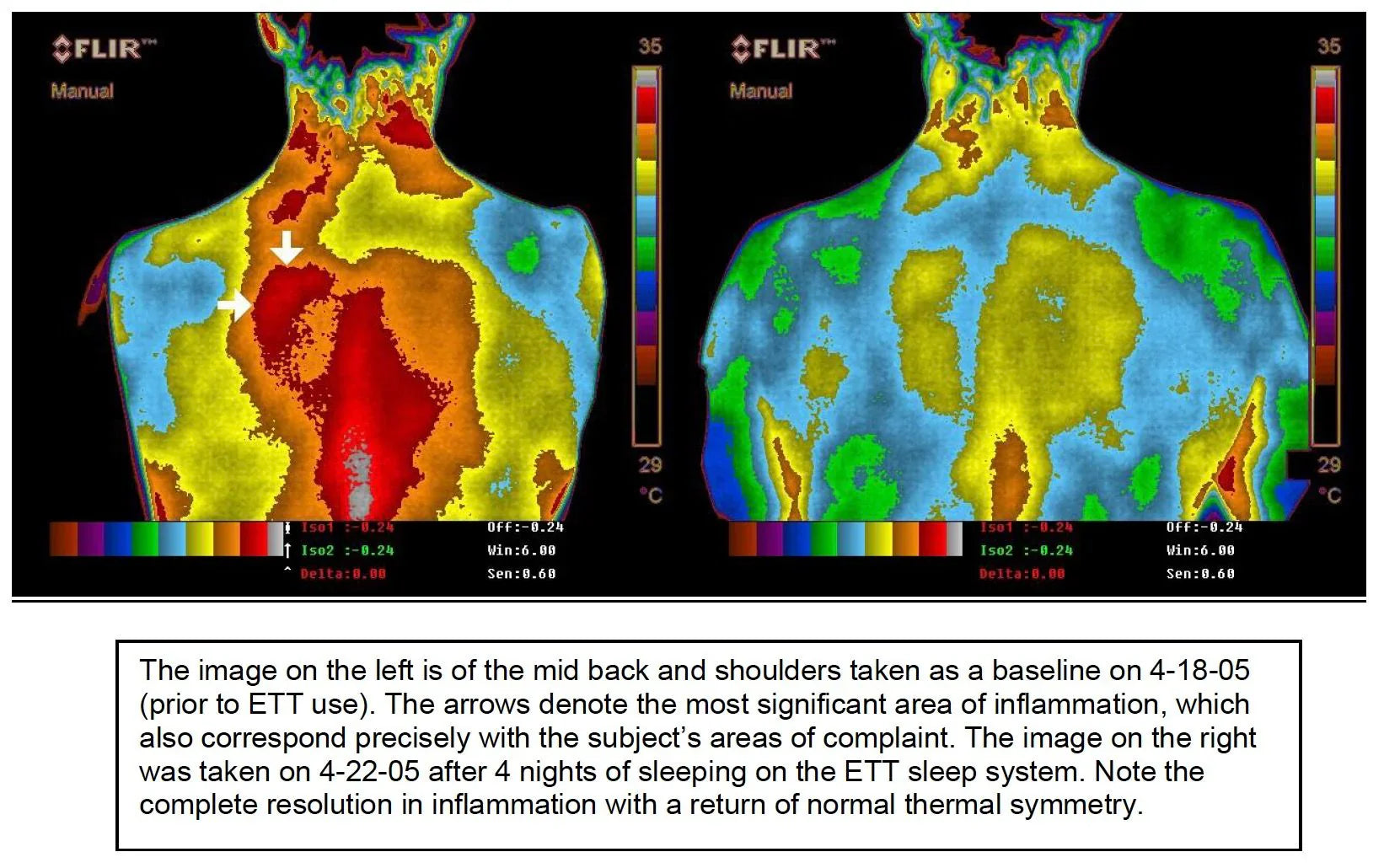 The evidence speaks for itself 20 studies on Grounding for health!(03)