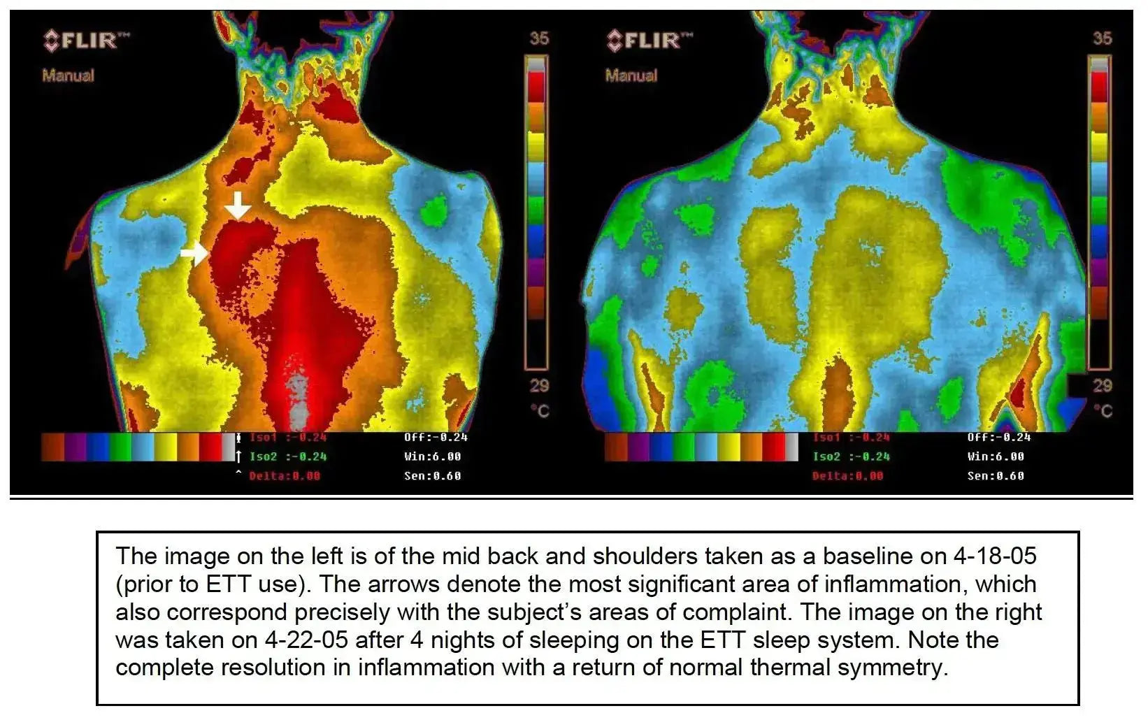 The-evidence-speaks-for-itself-20-studies-on-Grounding-for-health Earthbound™