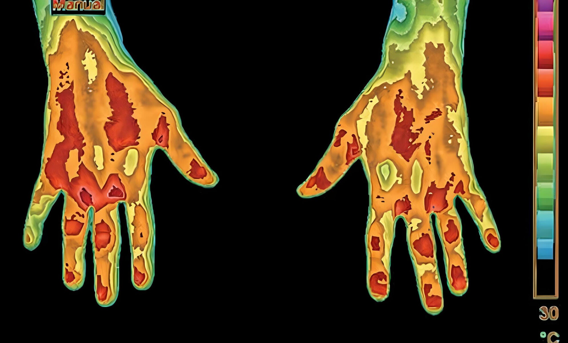 Thermal imaging of two hands with a color scale on the side.