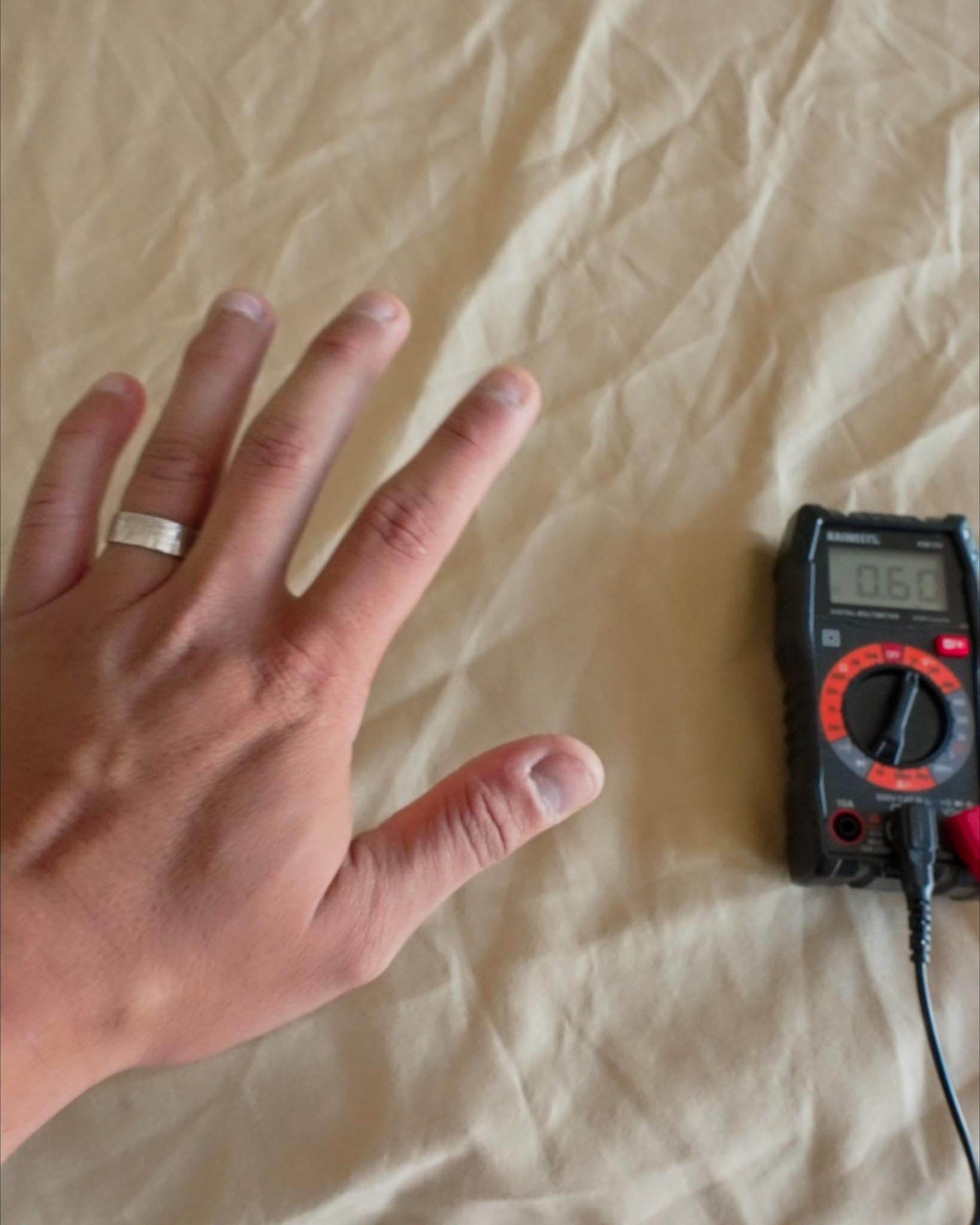 Hand resting on bed sheet connected to grounding mat with digital multimeter showing reduced body voltage reading